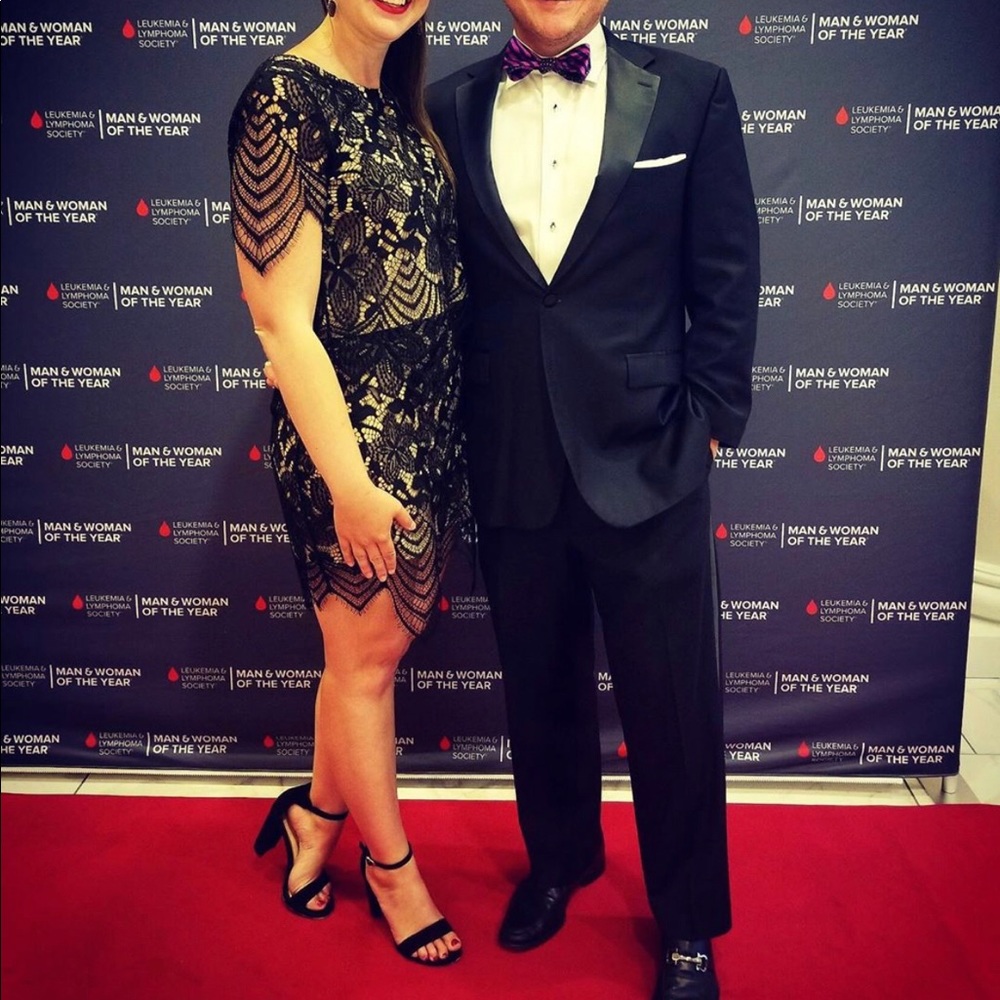 Two-piece Lace Dress Set - Perfect for Valentine’s